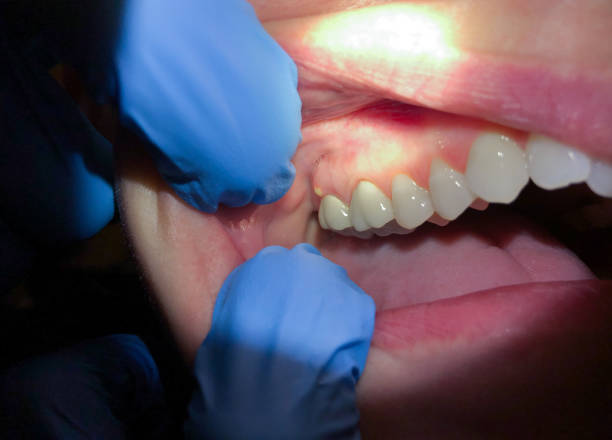 Best Pediatric Emergency Dentist in Sunman, IN